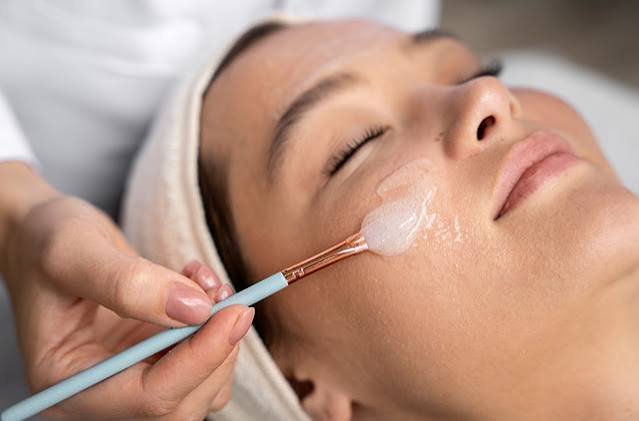 Chemical Peel treatment for pigmentation and acne